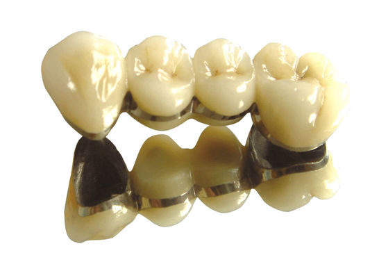 주문 치아 색 코발트 크롬 왕관 PFM 고귀 치아 PFM online manufacture