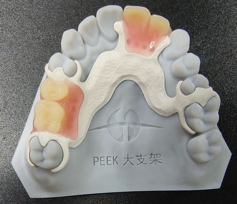 주문 커스터마이징 픽 제거 가능한 치아 부분 프레임 착용 저항 online manufacture