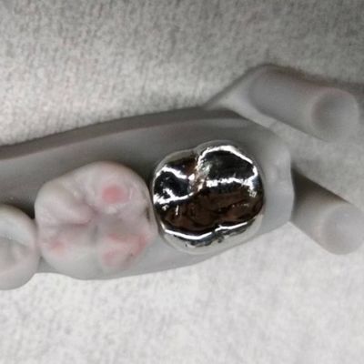 주문 전 금속 왕관과 다리 높은 정확성 은 임시 왕관 online manufacture