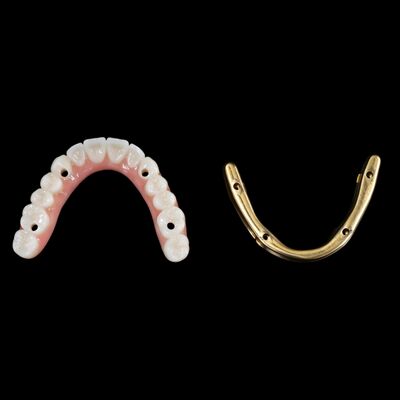 주문 하이브리드 치아 임플란트 티타늄 막대와 하이브리드 치아 online manufacture