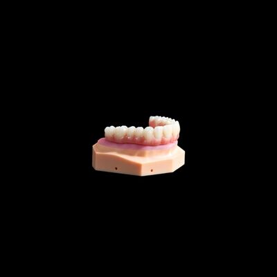 주문 티 베이스 크라운 임플란트 티타늄 크라운 / 브릿지 복합 물질에 대처 online manufacture