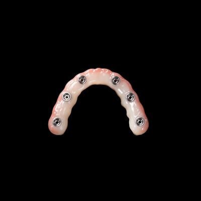 주문 즉각적 인 부하 치아 이식 밝은 분홍색 제거 가능한 인공 치아 online manufacture