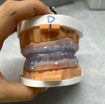 사용자 정의 가능한 3D 프린트 치아
